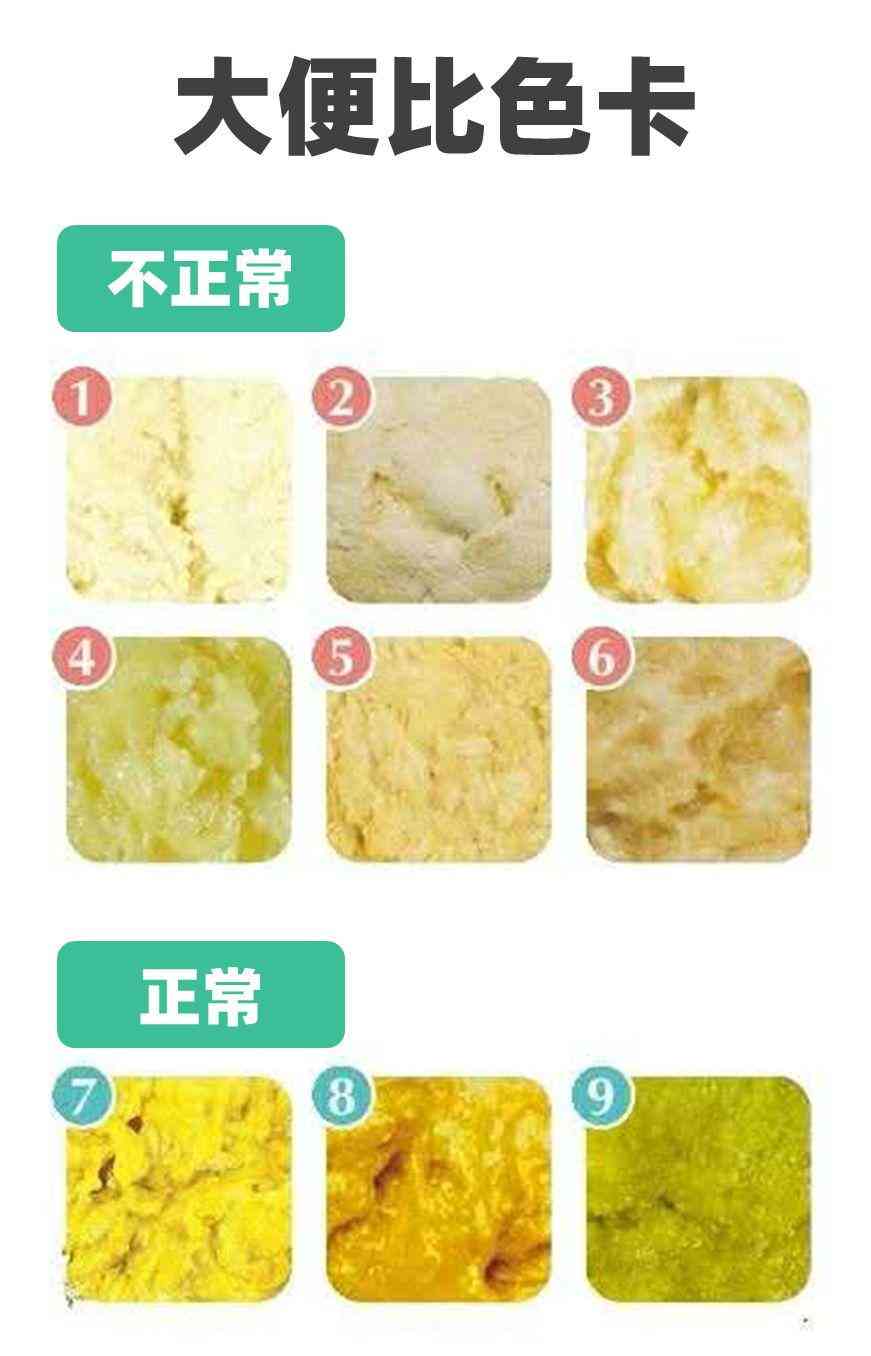 天使之吻胎記(紅色胎記手按壓就消失)插圖13