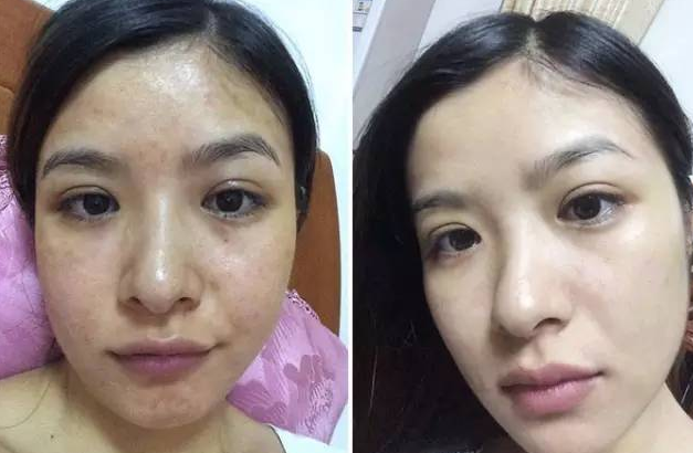 林心如現在用哪品牌化妝品(林心如曾經代言的化妝品品牌)插圖23